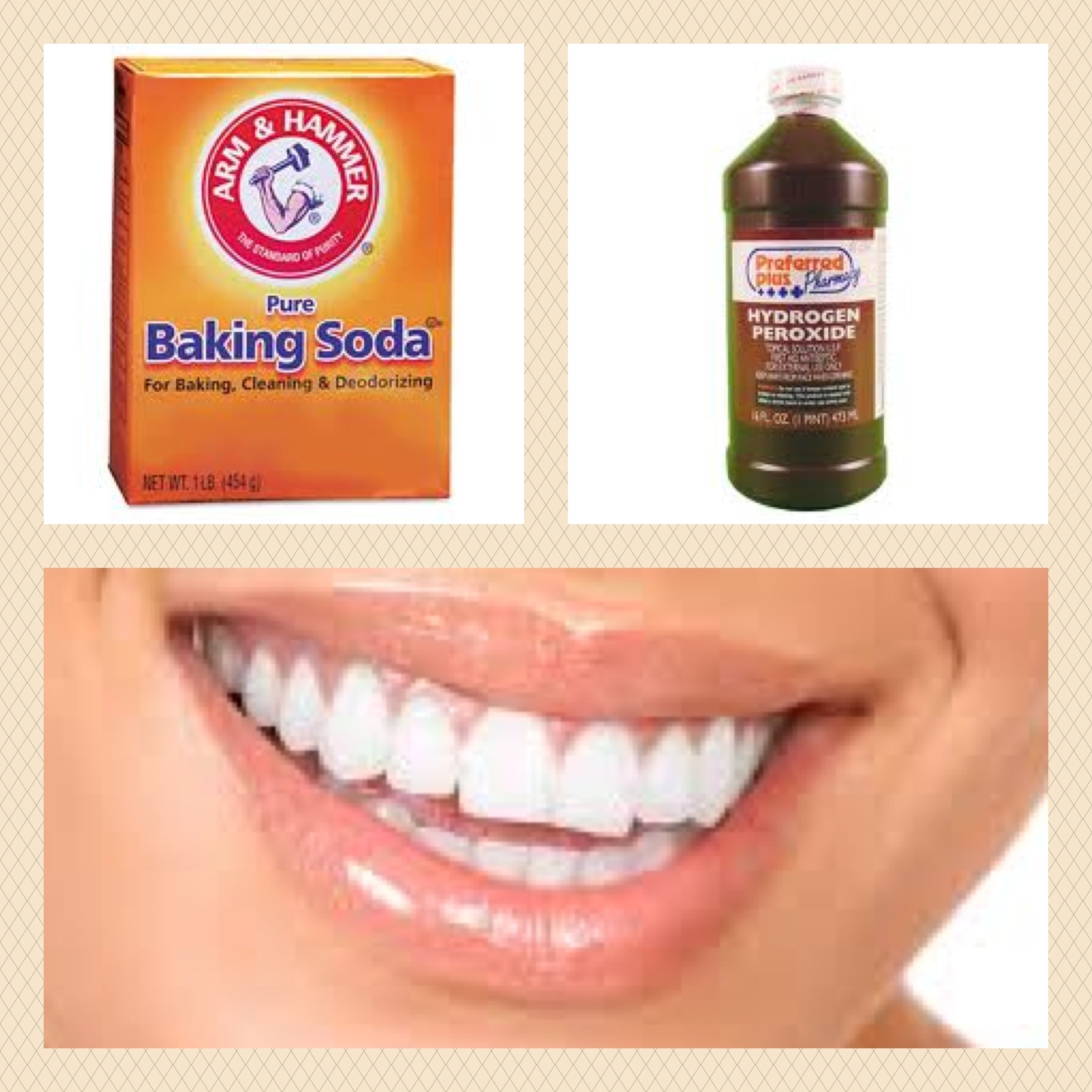 Teeth Whitening Trays Coupon Codes Best Reviews Teeth Whitening 